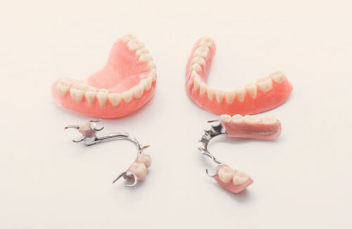 Prótesis-dentales