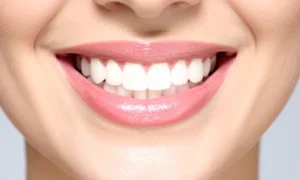 dientes amarillos