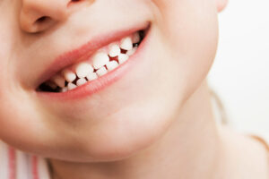 Dientes de leche